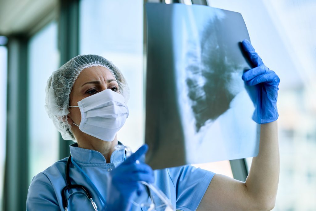 Home female radiologist analyzing chest xray patient medical clinic coronavirus epidemic min